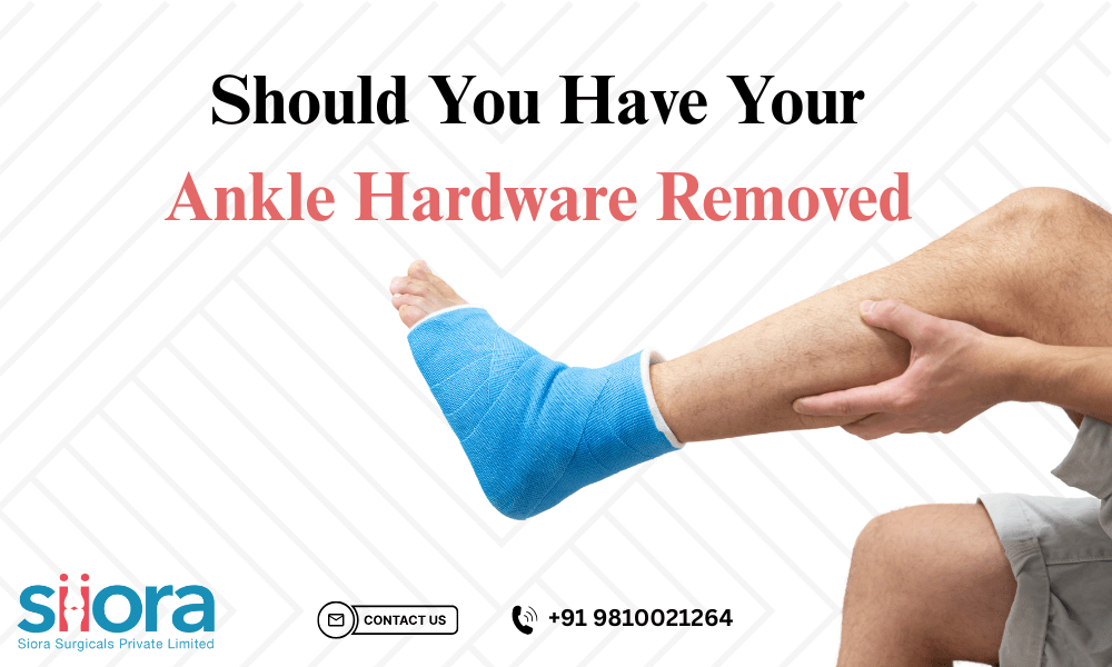 Should You Have Your Ankle Hardware Removed
