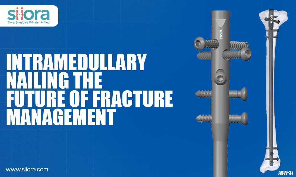Intramedullary Nailing: The Future of Fracture Management